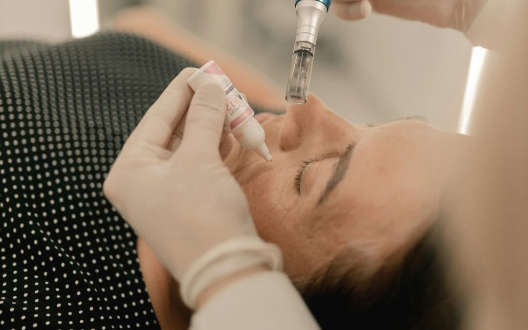 Microneedling Brampton