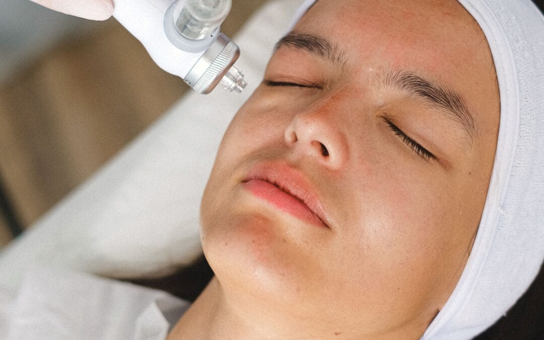 Is Advanced Professional Exfoliation Safe and Effective for Deeper Skin Tones?