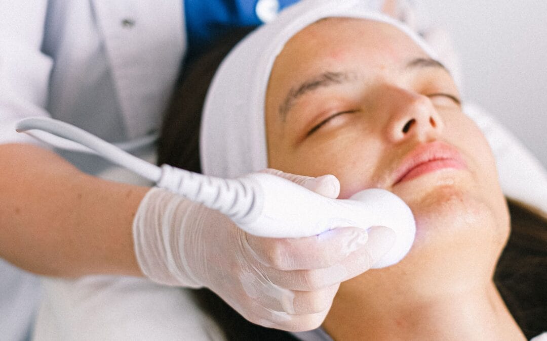 Skin Tightening Brampton